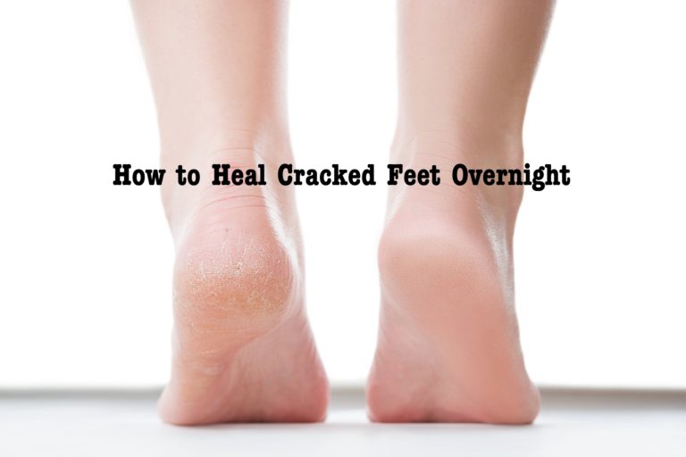 How to Heal Cracked Feet Overnight