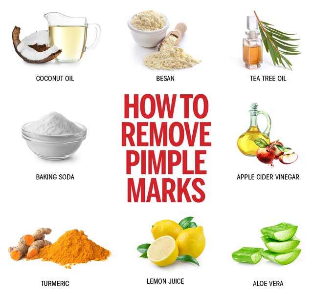 how-to-remove-acne-naturally-at-home