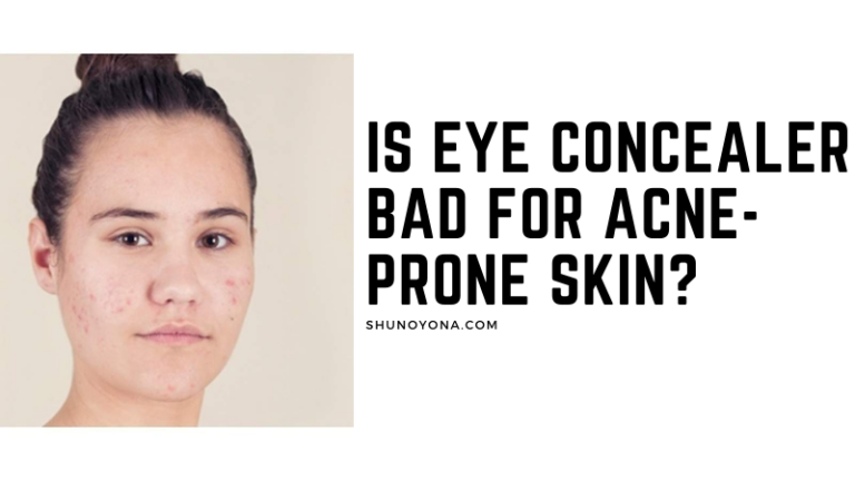 Is Eye Concealer Bad for Acne-Prone Skin?